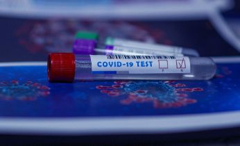 ¿Conoces las diferentes pruebas de detección de la COVID-19?